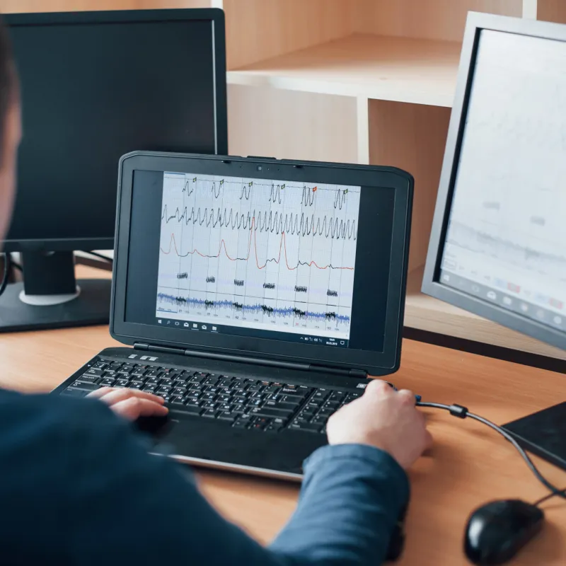 Monitorización Continua